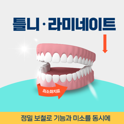구리치과 구리시 치과 틀니 라미네이트