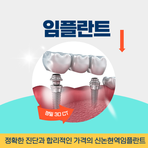 구리치과 구리시 치과 임플란트