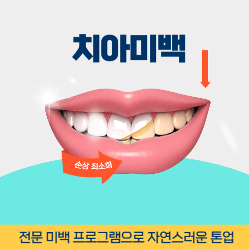 구리치과 구리시 치과 치아미백