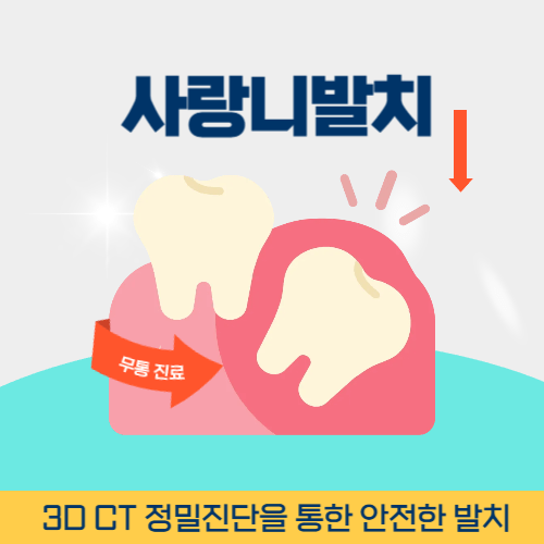 구리치과 구리시 치과 사랑니 발치