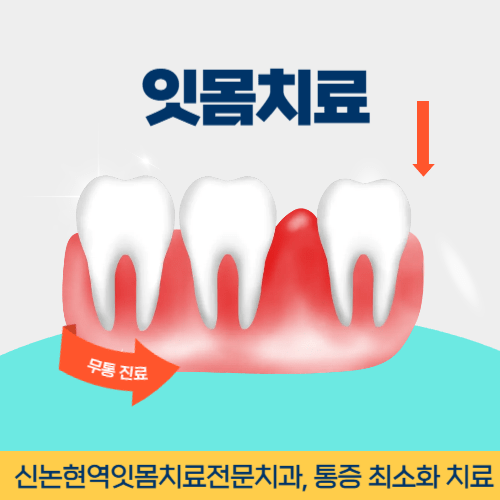 구리치과 구리시 치과 잇몸치료